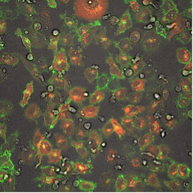 fluorescence microscope image shows iPSC-derived NK cells engineered to produce Umoja Biopharma’s RACR and universal TagCAR